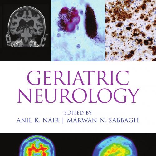 Geriatric Neurology