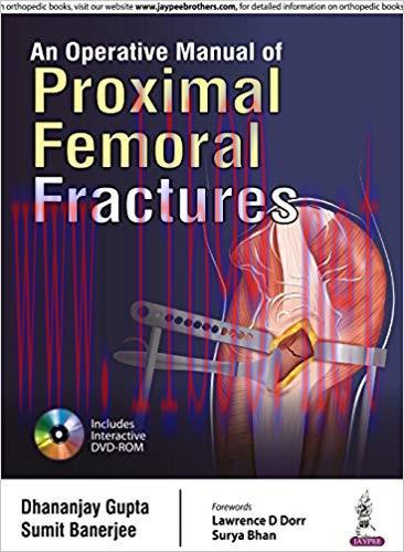 [PDF]An Operative Manual of Proximal Femoral Fractures