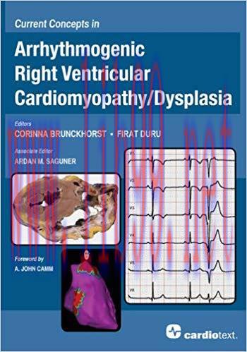 [PDF]Current Concepts in Arrhythmogenic Right Ventricular Cardiomyopathy-Dysplasia