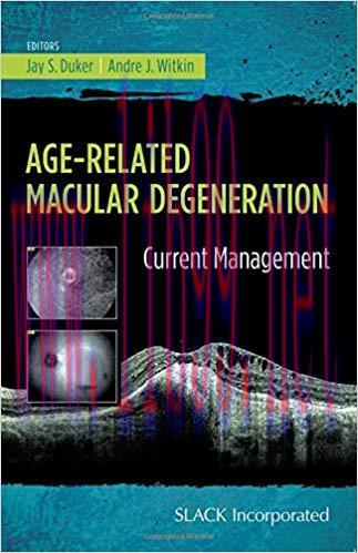 [PDF]Age-Related Macular Degeneration