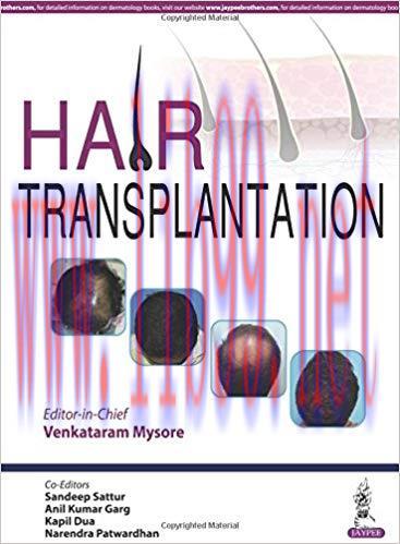 [PDF]Hair Transplantation [Venkataram Mysore]