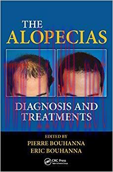 (PDF)The Alopecias: Diagnosis and Treatments 1st Edition