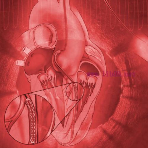 [AME]Mayo Clinic Interventional Cardiology Board Review 2019 (CME Videos)