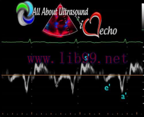 [AME]Mastering Left Ventricular Diastology - AllAboutUltrasound 2022 (Complete HTML)