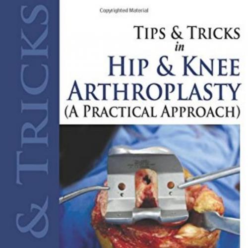 Tips and Tricks in Hip and Knee Arthroplasty (A Practical Approach) (2014) - Wei Zhi
