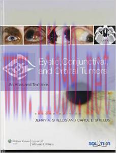[AME]Eyelid, Conjunctival, and Orbital Tumors and Intraocular Tumors: An Atlas and Text, 2nd Ed...