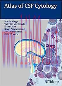 [PDF]Atlas of CSF Cytology, 1e [Thieme] [2006]