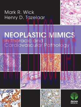 [AME]Neoplastic Mimics in Thoracic and Cardiovascular Pathology