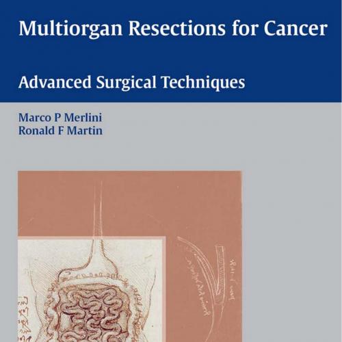Multiorgan Resections for Cancer - Wei Zhi