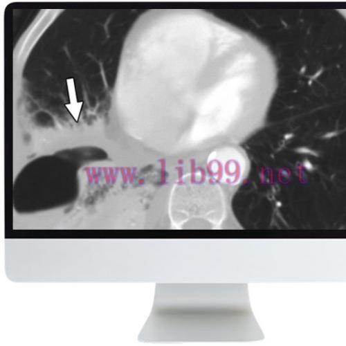 [AME]ARRS Radiology Review: Multispecialty Cases 2019 (CME Videos)