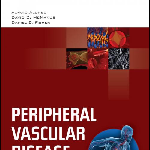 Peripheral Vascular Disease