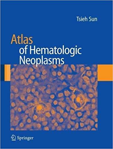 (PDF)Atlas of Hematologic Neoplasms 1st Edition