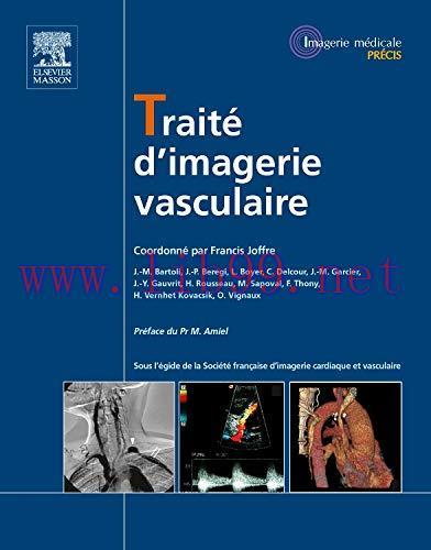 [AME]Trait&eacute; d'imagerie Vasculaire (Imagerie m&eacute;dicale : Pr&eacute;cis) (French Edition) (Original PDF)