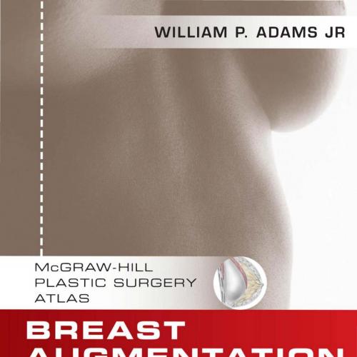 Breast Augmentation