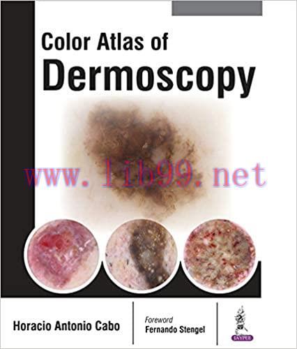 [AME]Color Atlas of Dermoscopy (Original PDF)