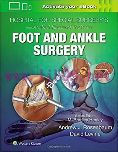 [EPUB]Hospital for Special Surgery’s Illustrated Tips and Tricks in Foot and Ankle Surgery