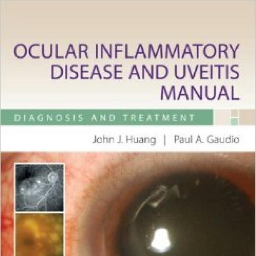 Ocular Inflammatory Disease and Uveitis Manual _ Diagnosis and Treatment