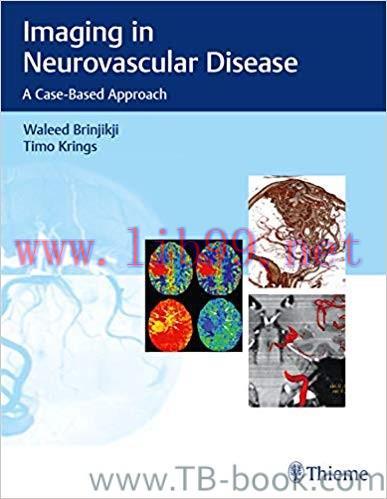 Imaging in Neurovascular Disease: A Case-Based Approach 1st Edition by Waleed Brinjikji