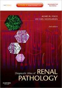 [AME]Diagnostic Atlas of Renal Pathology: Expert Consult - Online and Print, 2nd Edition (Origi...
