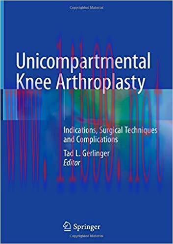 [AME]Unicompartmental Knee Arthroplasty: Indications, Surgical Techniques and Complications 1st...