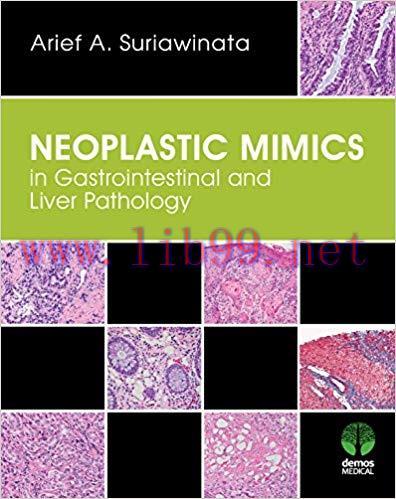 [PDF]Neoplastic Mimics in Gastrointestinal and Liver Pathology (Pathology of Neoplastic Mimics)