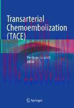 [PDF]Transarterial Chemoembolization (TACE)