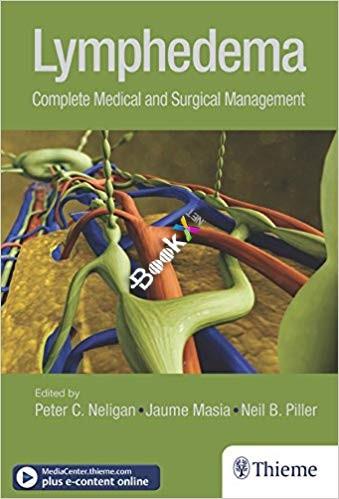 Lymphedema Complete Medical and Surgical Management [Peter C. Neligan]