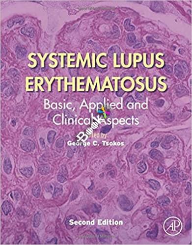 Systemic Lupus Erythematosus 2nd edition
