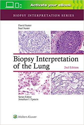 Biopsy Interpretation of the Lung (Biopsy Interpretation Series) 2nd Edition