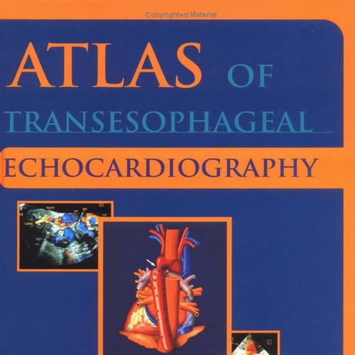 Atlas of Transesophageal Echocardiography 2nd Edition