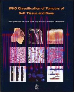 [AME]WHO Classification of Tumours of Soft Tissue and Bone (IARC WHO Classification of Tumours)...