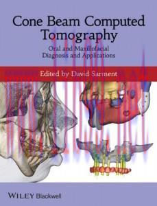 [AME]Cone Beam Computed Tomography: Oral and Maxillofacial Diagnosis and Applications