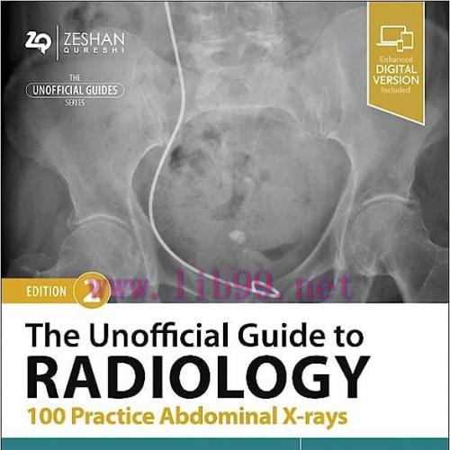 [AME]The Unofficial Guide to Radiology: 100 Practice Abdominal X-rays, 2nd edition (ePub+Conver...
