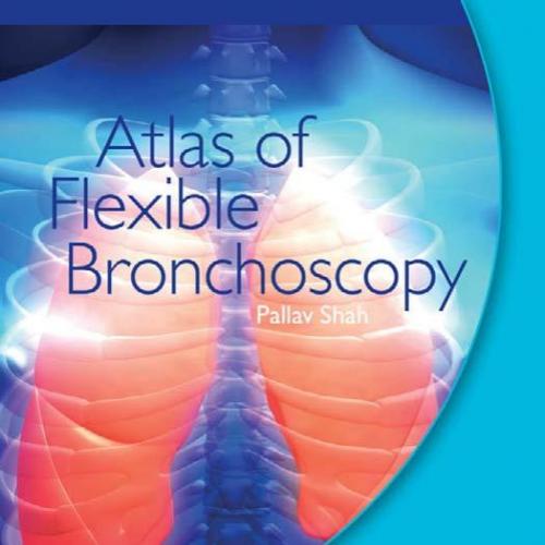 Atlas of flexible bronchoscopy