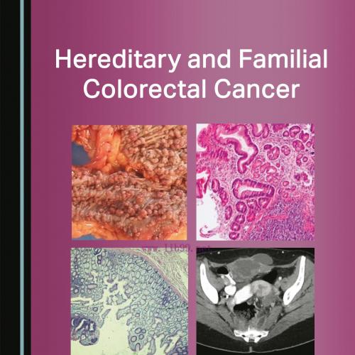 [AME]Hereditary and Familial Colorectal Cancer (Original PDF)