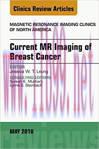 [PDF]Current MR Imaging of Breast Cancer, An Issue of Magnetic Resonance Imaging Clinics of Nor...