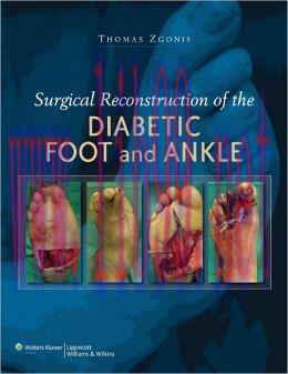 [AME]Surgical Reconstruction of the Diabetic Foot and Ankle