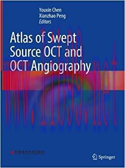 [AME]Atlas of Swept Source OCT and OCT Angiography (Original PDF)