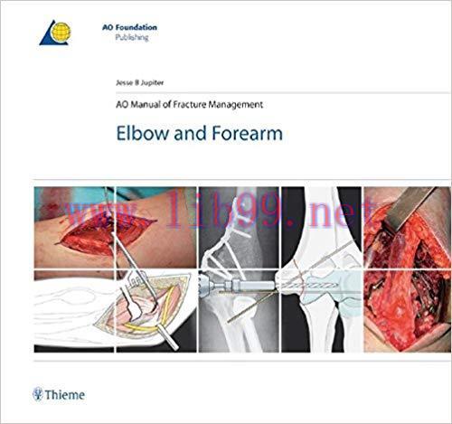 [PDF]AO Manual of Fracture Management Elbow and Forearm, 1e [Thieme] [2009]