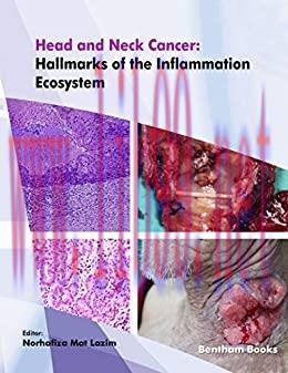 [AME]Head and Neck Cancer: Hallmarks of The Inflammation Ecosystem-Volume 2 (EPUB & Converted P...