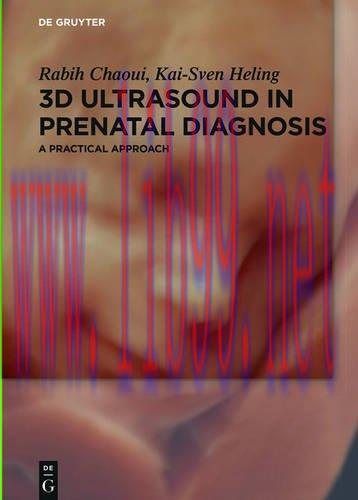 [AME]3D Ultrasound in Prenatal Diagnosis: A Practical Approach (Original PDF)