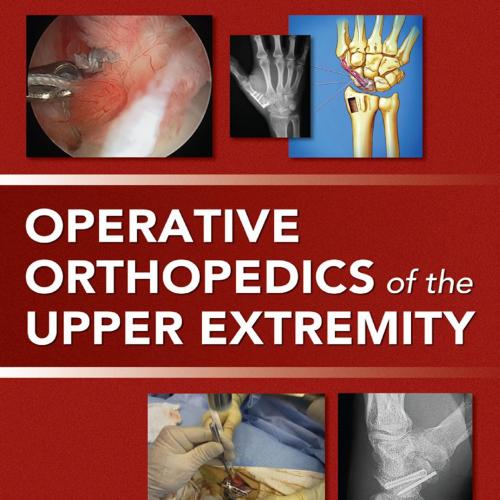 Operative Orthopedics of the Upper Extremity