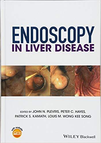 Endoscopy in Liver Disease