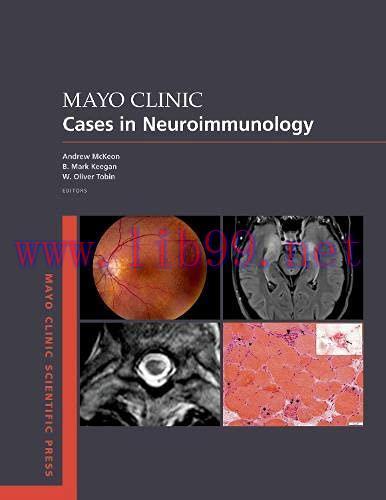 [AME]Mayo Clinic Cases in Neuroimmunology (MAYO CLINIC SCIENTIFIC PRESS SERIES) (Original PDF)