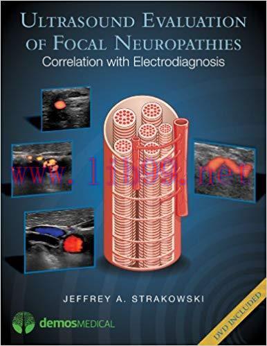 (PDF)Ultrasound Evaluation of Focal Neuropathies: Correlation with Electrodiagnosis 1st Edition