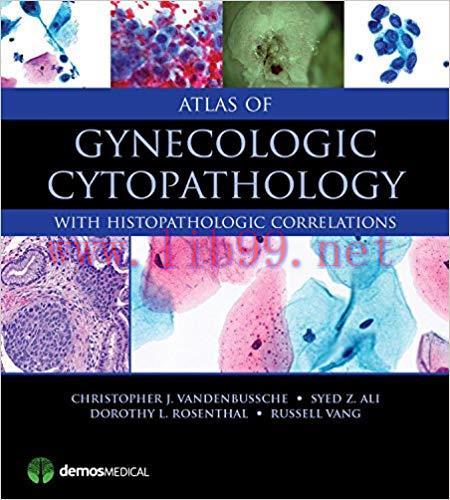 [PDF]Atlas of Gynecologic Cytopathology With Histopathologic Correlations