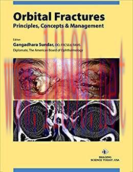 [AME]Orbital Fractures: Principles, Concepts & Managements (azw3+ePub+Converted PDF)