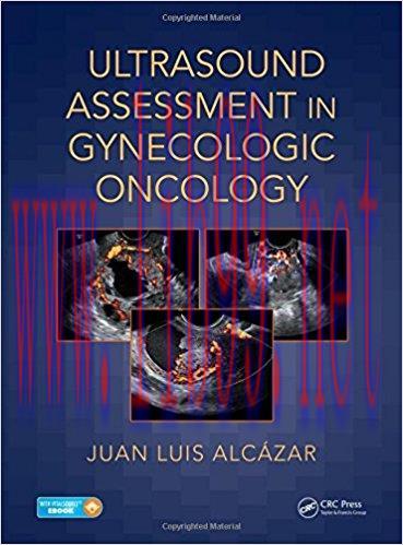 [AME]Ultrasound Assessment in Gynecologic Oncology (PDF)