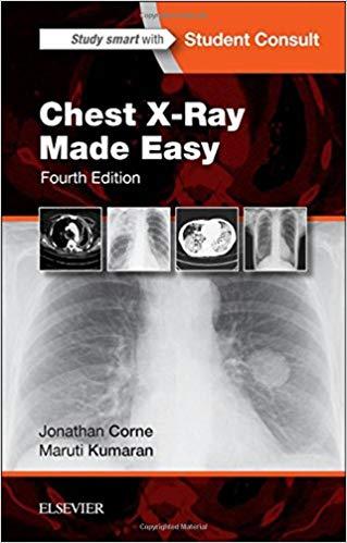 Chest X-ray Made Easy,Fourth Edition