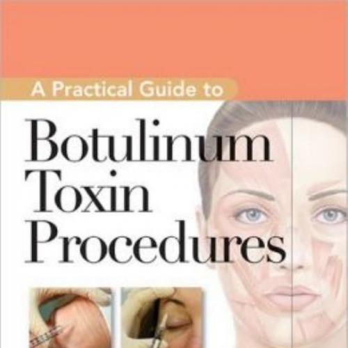 Practical Guide to Botulinum Toxin Procedures, A